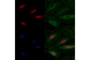 ABIN6257236 and ABIN6275800 staining  cells by IF/ICC. (GATA6 Antikörper  (Internal Region))