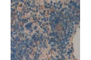 Used in DAB staining on fromalin fixed paraffin- embedded Kidney tissue (VSNL1 Antikörper  (AA 39-184))