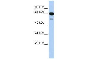 DAZ1 antibody used at 1 ug/ml to detect target protein.