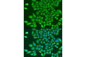 Immunofluorescence analysis of U2OS cells using TUBGCP3 antibody. (TUBGCP3 Antikörper  (AA 1-250))