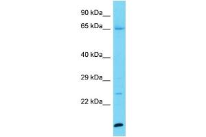 Host: Rabbit Target Name: KPRP Sample Type: Jurkat Whole Cell lysates Antibody Dilution: 1.