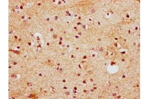 IHC image of ABIN7155766 diluted at 1:400 and staining in paraffin-embedded human brain tissue performed on a Leica BondTM system. (Homeobox D13 Antikörper  (AA 151-254))