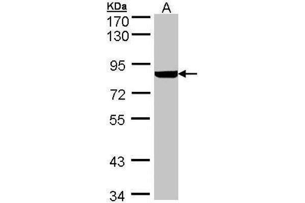 PFKL anticorps  (Center)