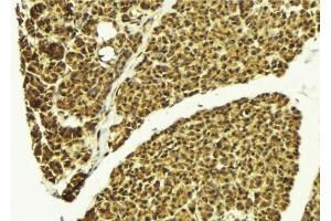 ABIN6276391 at 1/100 staining Mouse pancreas tissue by IHC-P. (SMNDC1 Antikörper)