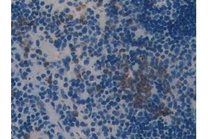 Immunohistochemistry (IHC) image for anti-serpin Peptidase Inhibitor, Clade B (Ovalbumin), Member 1 (SERPINB1) (AA 184-368) antibody (ABIN7435499)