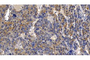 Immunohistochemistry (IHC) image for anti-Peptidoglycan Recognition Protein 1 (PGLYRP1) (AA 22-196) antibody (ABIN7435673)