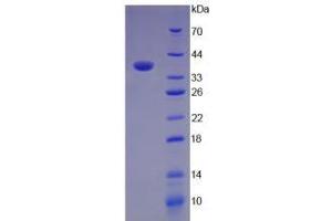 SDS-PAGE analysis of Mouse C3a Protein. (C3a Protein)