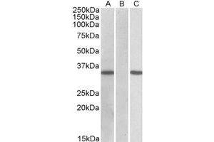 HEK293 lysate (10µg protein in RIPA buffer) overexpressing Human CRISP2 with C-terminal MYC tag probed with AP21266PU-N CRISP2 Antibody (1 µg/ml) in Lane A and probed with anti-MYC Tag (1/1000) in lane C. (CRISP2 Antikörper  (AA 77-89))