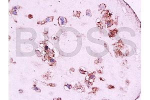 Formalin-fixed and paraffin embedded human placenta tissue labeled with Anti-CD105 Polyclonal Antibody, Unconjugated at 1:200, followed by conjugation to the secondary antibody and DAB staining (Endoglin Antikörper  (AA 601-658))