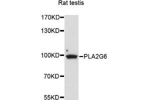 Western blot analysis of extracts of rat testis, using PLA2G6 antibody (ABIN5996267) at 1/1000 dilution. (PLA2G6 Antikörper)