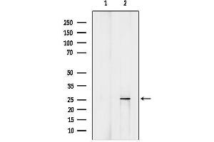 anti-B-Cell Translocation Gene 1, Anti-Proliferative (BTG1) (C-Term) antibody