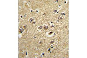 Immunohistochemistry (Paraffin-embedded Sections) (IHC (p)) image for anti-Low Density Lipoprotein Receptor-Related Protein Associated Protein 1 (LRPAP1) (AA 281-309), (C-Term) antibody (ABIN652468)