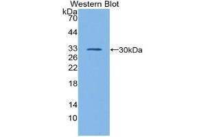Detection of Recombinant GATA1, Mouse using Polyclonal Antibody to GATA Binding Protein 1 (GATA1) (GATA1 Antikörper  (AA 20-265))