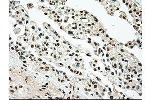 Image no. 1 for anti-TYRO3 Protein Tyrosine Kinase (TYRO3) antibody (ABIN1501608) (TYRO3 Antikörper)