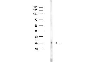 anti-Eukaryotic Translation Initiation Factor 3 Subunit K (EIF3K) (N-Term) antibody