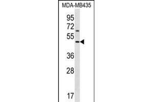 KERA Antibody (C-term) (ABIN656548 and ABIN2845810) western blot analysis in MDA-M cell line lysates (35 μg/lane). (KERA Antikörper  (C-Term))