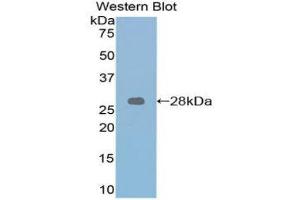 Western Blotting (WB) image for anti-Retinoic Acid Receptor, alpha (RARA) (AA 237-459) antibody (ABIN1860407) (Retinoic Acid Receptor alpha Antikörper  (AA 237-459))