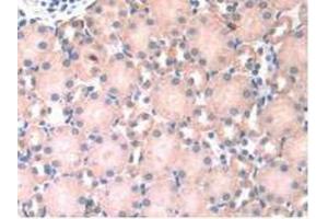 Immunohistochemistry (IHC) image for anti-Heparanase (HPSE) (AA 280-412) antibody (ABIN7437677)