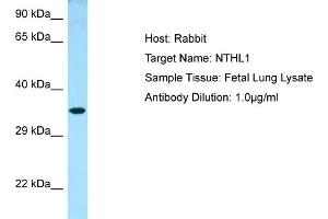 Western Blotting (WB) image for anti-Nth Endonuclease III-Like 1 (NTHL1) (N-Term) antibody (ABIN2789777) (Nth Endonuclease III-Like 1 (NTHL1) (N-Term) Antikörper)
