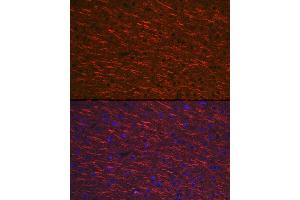 Immunofluorescence analysis of mouse brain cells using M Rabbit pAb (ABIN3016264, ABIN3016265, ABIN3016266, ABIN1680752 and ABIN6219676) at dilution of 1:100 (40x lens). (MAP2 Antikörper  (AA 260-559))