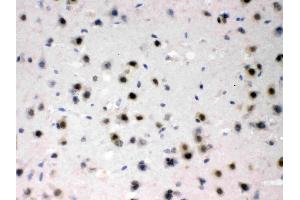 AZIN2 was detected in paraffin-embedded sections of mouse brain tissues using rabbit anti- AZIN2 Antigen Affinity purified polyclonal antibody (Catalog # ) at 1 µg/mL. (ADC Antikörper  (AA 111-301))