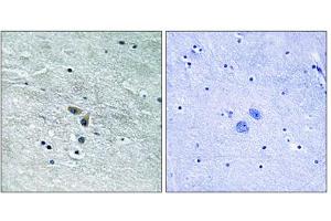 Immunohistochemistry analysis of paraffin-embedded human brain tissue using MAP3K8 (epitope around residue 400) antibody. (MAP3K8 Antikörper  (Ser400))