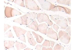 Detection of SERPINA10 in Rat Skeletal muscle Tissue using Polyclonal Antibody to Serpin A10 (SERPINA10)