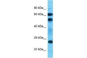 Host:  Rabbit  Target Name:  MLLT4-AS1  Sample Type:  Uterus Tumor lysates  Antibody Dilution:  1. (MLLT4-AS1 Antikörper  (C-Term))