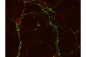 anti-Synaptic Vesicle Glycoprotein 2C (SV2C) (AA 2-16) antibody