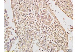 Formalin-fixed and paraffin embedded rat brain labeled with Rabbit Anti TAK1/MAP3K7 Polyclonal Antibody, Unconjugated (ABIN701185) at 1:200 followed by conjugation to the secondary antibody and DAB staining (TR4 Antikörper  (AA 560-600))