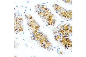 Immunohistochemistry of paraffin-embedded human stomach using SIRT1 antibody (ABIN5970059) at dilution of 1/100 (40x lens). (SIRT1 Antikörper  (C-Term))