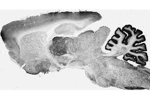 Adult rat brain immunohistochemistry. (Cav3.1 Ca2+ Channel (AA 2052-2172), (C-Term), (Cytosolic) Antikörper)