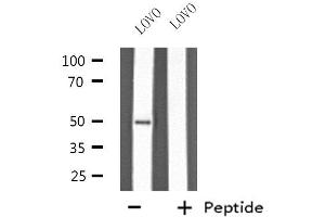 Western blot analysis of extracts from LOVO cells, using KRT37/38 antibody. (KRT37,38 Antikörper)