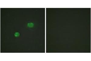 Immunofluorescence analysis of HeLa cells, using c-Jun (Ab-231) Antibody. (C-JUN Antikörper  (AA 201-250))