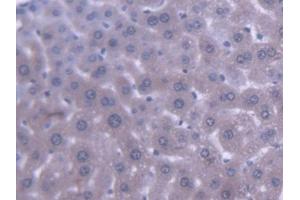 DAB staining on IHC-P; Samples: Mouse Liver Tissue (ABCB9 Antikörper  (AA 500-762))