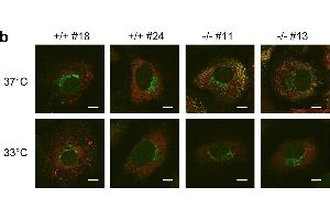 Immunofluorescence (Cultured Cells) (IF (cc)) image for anti-Collagen, Type I (COL1) antibody (ABIN5596819)