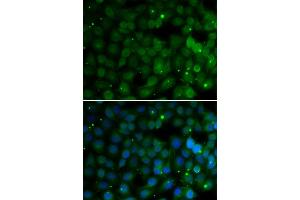 Immunofluorescence analysis of U20S cell using HPD antibody. (HPD Antikörper)