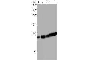 Western Blotting (WB) image for anti-MOB1, Mps One Binder Kinase Activator-Like 1B (MOBKL1B) antibody (ABIN2433399) (MOB1A Antikörper)
