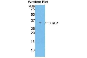 Western Blotting (WB) image for anti-Signal Transducer and Activator of Transcription 1, 91kDa (STAT1) (AA 343-602) antibody (ABIN3206143) (STAT1 Antikörper  (AA 343-602))