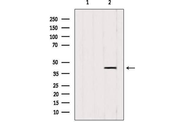 ACAA1 Antikörper  (N-Term)