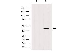Western blot analysis of extracts from 3T3, using ACAA1 antibody.