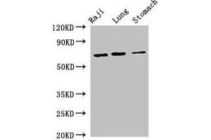 Western Blot Positive WB detected in: Raji whole cell lysate, Mouse lung tissue, Mouse stomach tissue All lanes: FOXN1 antibody at 2. (FOXN1 Antikörper  (AA 1-160))