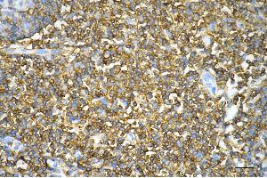 Immunohistochemistry was performed on paraffin-embedded human tonsillitis using CD44 antibody (ABIN7797973), 1:200). (Rekombinanter CD44 Antikörper)