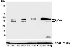 Western Blotting (WB) image for anti-Epithelial Cell Adhesion Molecule (EPCAM) (AA 264-314) antibody (ABIN7455204) (Rekombinanter EpCAM Antikörper  (AA 264-314))