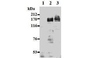 Western Blotting (WB) image for anti-Ankyrin Repeat-Containing Protein (EHMT2) (AA 621-1000), (C-Term) antibody (ABIN1449182) (EHMT2 Antikörper  (C-Term))