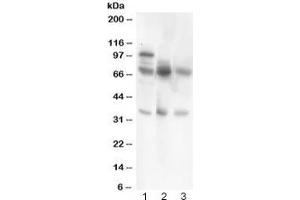Western blot testing of GAD67 antibody and Lane 1:  rat brain;  2: human HeLa;  3: (h) COLO320. (GAD Antikörper  (AA 14-122))
