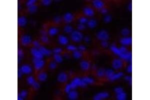 Immunofluorescence analysis of Rat kidney tissue using JAK3 Polyclonal Antibody at dilution of 1:200. (JAK3 Antikörper)