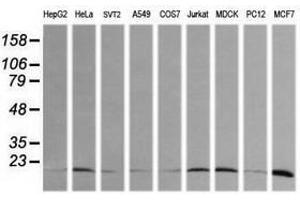 Image no. 2 for anti-HRas proto-oncogene, GTPase (HRAS) antibody (ABIN1498713) (HRAS Antikörper)