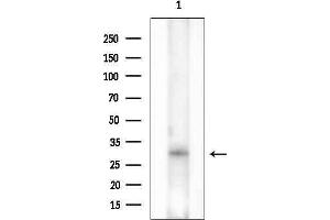 Western blot analysis of lysates from EC304 cells(heat-shock treatment), using MAGF1 Antibody at 1/1000 dilution.