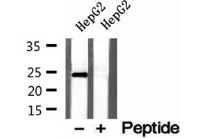 Western blot analysis of extracts of HepG2 cells, using Cyclophilin B antibody.